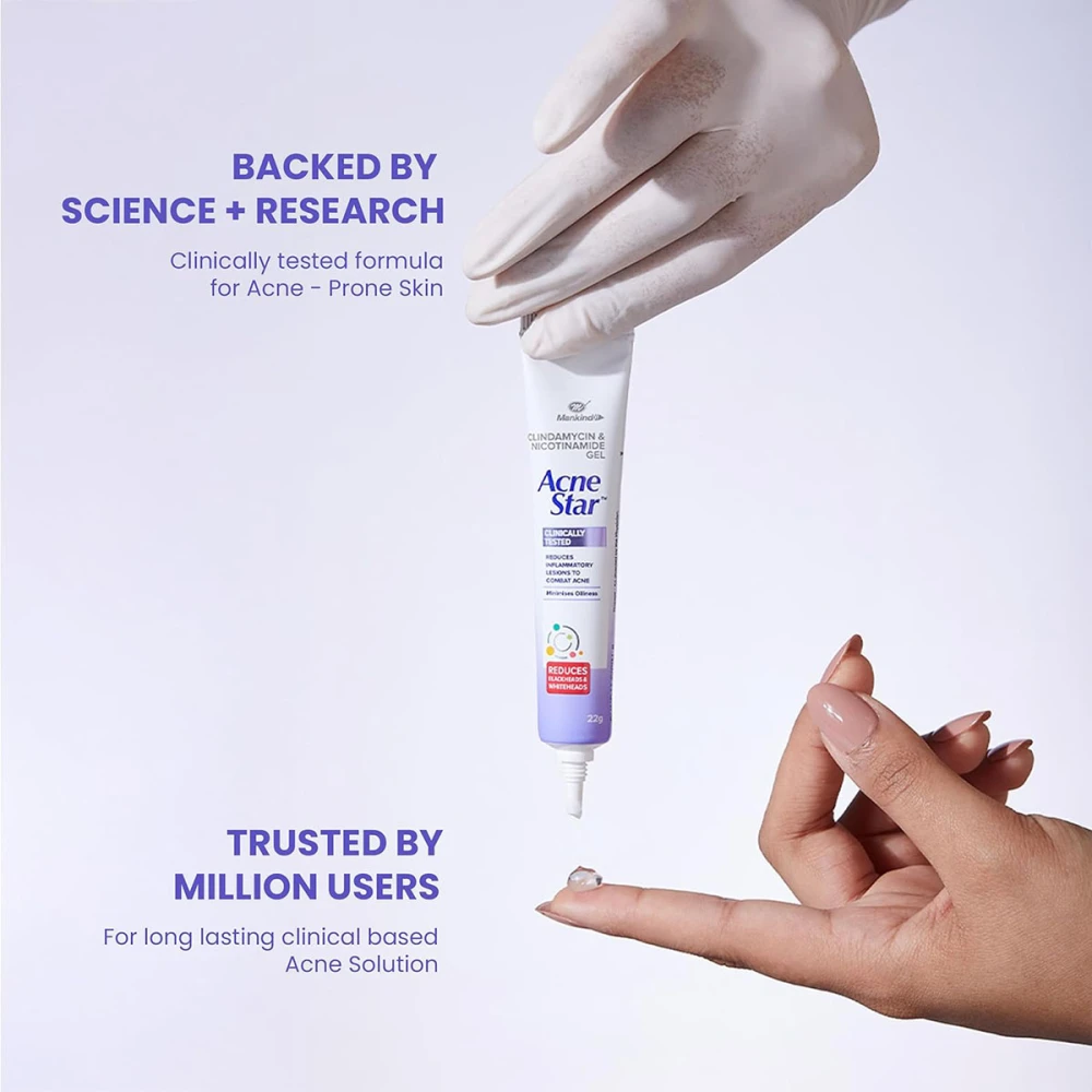 AcneStar Gel Cream For Pimples 15gm